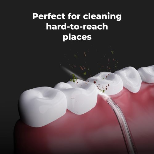 AENO Dental Irrigator